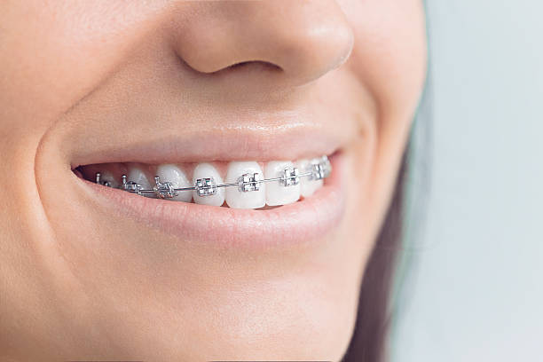 Dental Inlays and Onlays in Dimmitt, TX